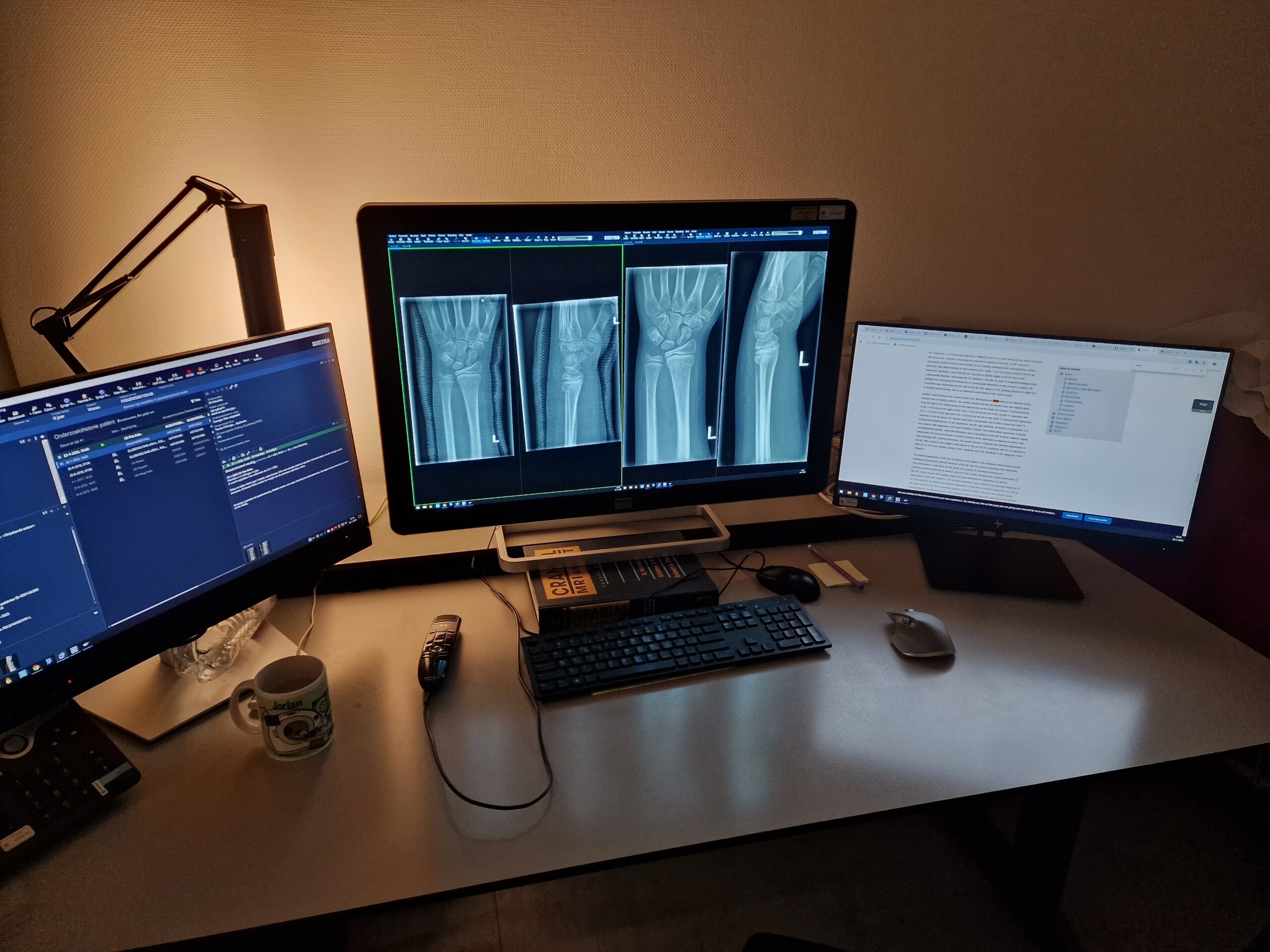 Werkplek van een radioloog (in opleiding)